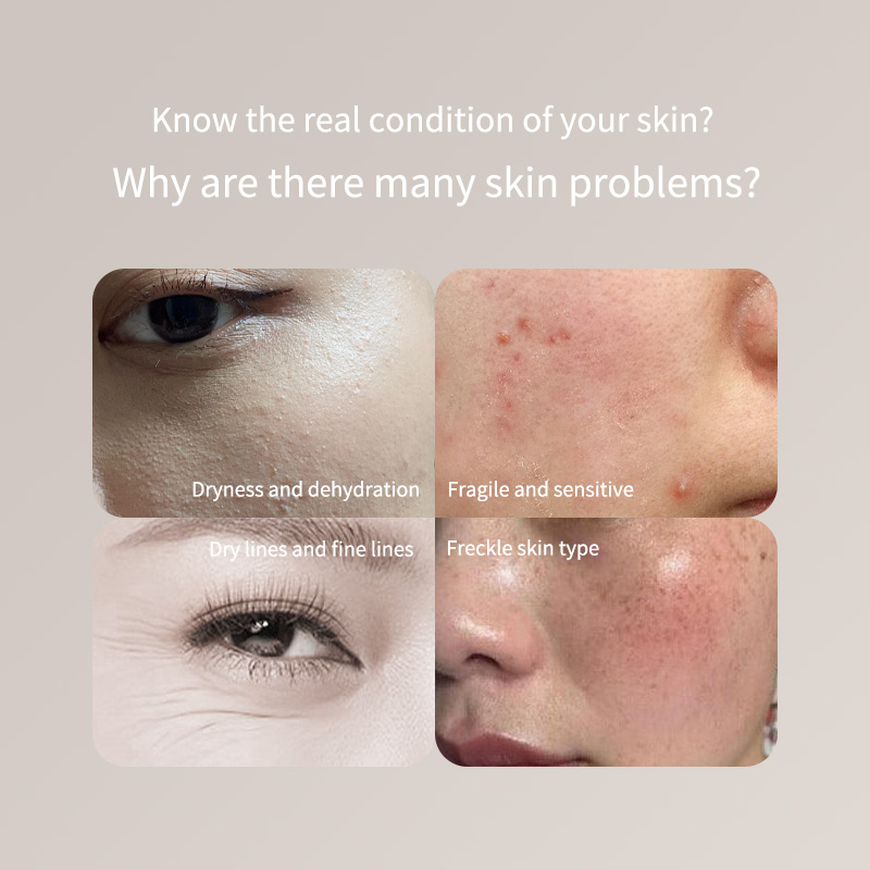 Skincare Only You - Caneta testadora de pele portátil-para rosto