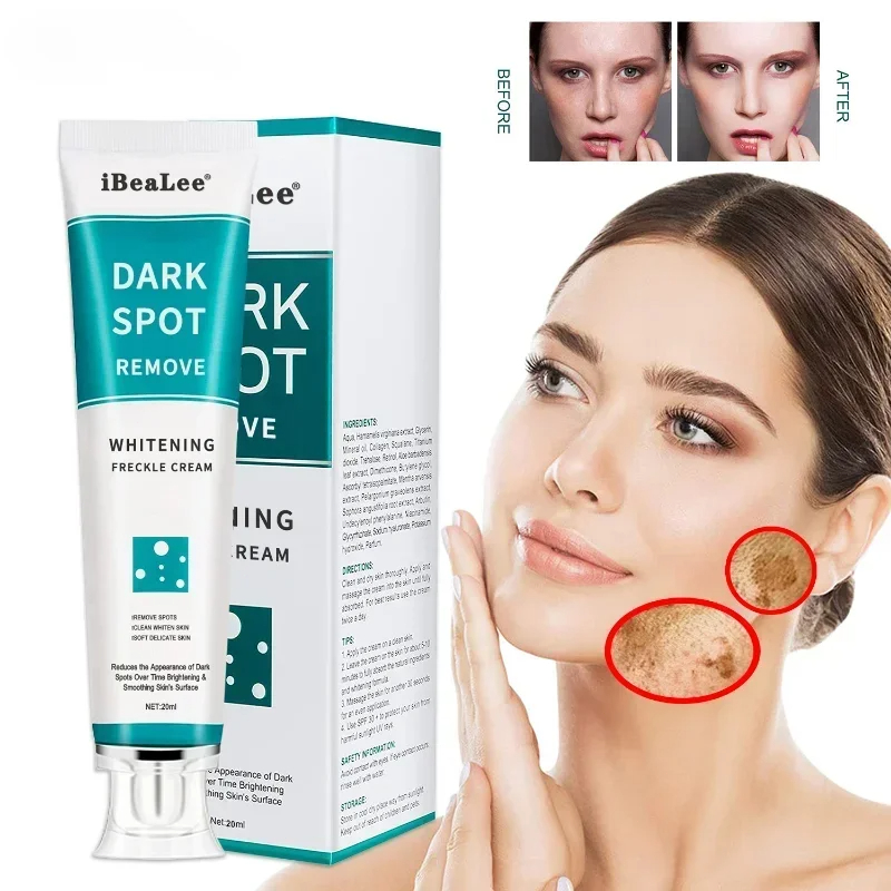 Clareamento creme de sardas re - Skincare Glowing avaliação e preço