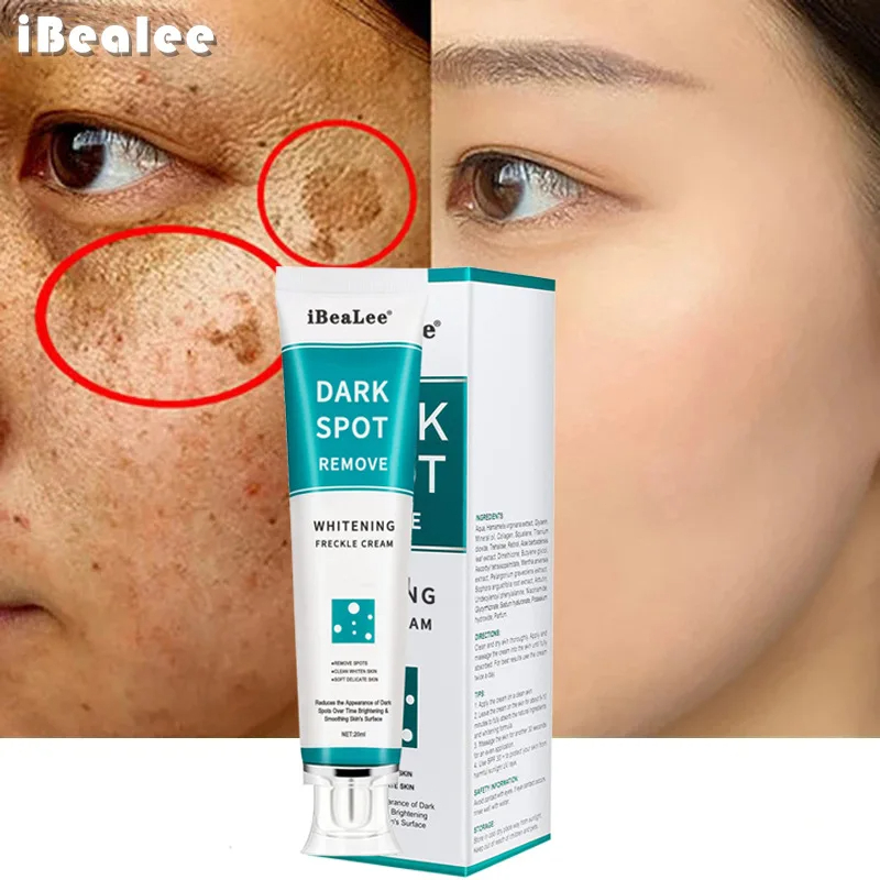 Clareamento creme de sardas re - Skincare Glowing avaliação e preço