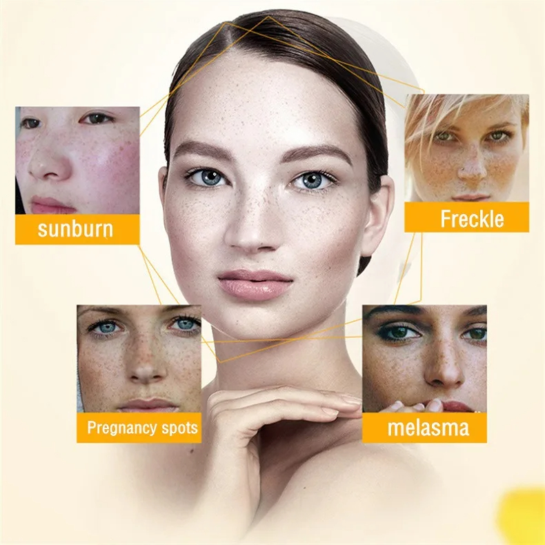 Clareamento creme de sardas re - Skincare Glowing avaliação e preço