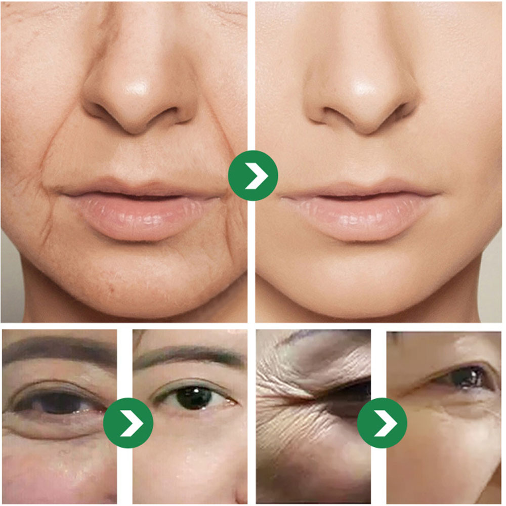 Creme japonês com seis peptíde - Eye Cream Peptide avaliação e preço